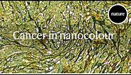 Cancer in nanocolour: a new type of microscope slide