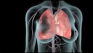DVT and Pulmonary Embolism | Nucleus Health