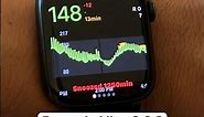 How to get Libre 2 & 3 Readings on Apple Watch #cgm #t1d #diabetes