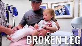 Getting a cast on her Broken leg!