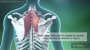 Upper Back Pain Reasons