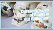 different types of real Human skulls!?