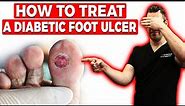 How to Treat a Diabetic Foot Ulcer [Early Signs, Causes & Treatment]