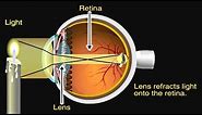 How the Eye Works Animation - How Do We See Video - Nearsighted & Farsighted Human Eye Anatomy