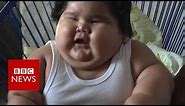 Why is this baby so overweight? - BBC News
