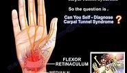Patient Self Diagnose Carpal Tunnel Syndrome - Everything You Need To Know - Dr. Nabil Ebraheim