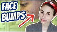 How to get rid of bumps on the face| Dr Dray