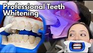 Teeth Whitening At The Dentist | Fastest Way To Whiten Your Teeth