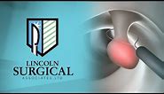 Polyp Removal - Dr. Deirdre Hart, Colon and Rectal Surgeon - Lincoln Surgical Associates, Shiloh, IL