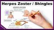 Herpes Zoster/Shingles Symptoms, Diagnosis, Treatment