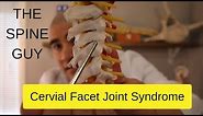 Cervical Facet Joint Syndrome