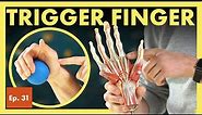What is Trigger Finger and How Do I Fix It? (Stenosing Tenosynovitis)