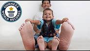 Jeison Rodriguez Hernandez: Largest feet in the world! - Guinness World Records