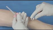 BD Nexiva™ Single Port Closed IV Catheter Insertion Techniques