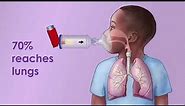 Asthma Inhaler with Spacer