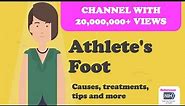 Athlete's Foot - Causes, treatments, tips and more