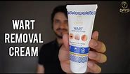 7 Days Organic Wart Removal Cream| Best Wart Removal cream | Easy & Effective|