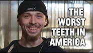 Mountain Dew Mouth and the Worst Teeth in America