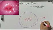 Colposcopy-Basics-Cervix Structure & Histology-Transformation Zone-Normal Cervix@Love_Obs_Gynae