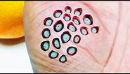 20 Worst Images for Trypophobia