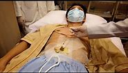 Ancient CHINESE ACUPUNCTURE Therapy Treatment (Moxibustion)