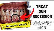 Treat Gum Recession | Symptoms | Causes