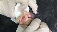 Popping a Sebaceous Cyst on a Dog