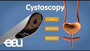 Cystoscopy (overactive bladder)