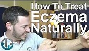 How To Treat Eczema Naturally