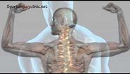 Shoulder Impingement Syndrome - Shoulder pain - Explained in a Minute