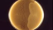 Clostridium - What is it? Morphology, Classification, Characteristics