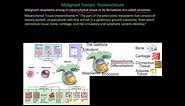112P - Nomenclature of benign and malignant cancers, How to name cancers, mixed tumors explained