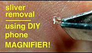 Satisfying Splinter Removal ● Using iphone DIY Magnifier Lens ( not for the squeamish ! )