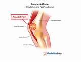Pictures of Knee Pain Diagnosis