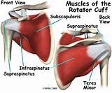 Injuries To Rotator Cuff Images