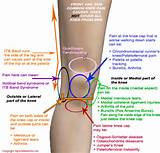 Knee Injury Images