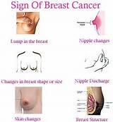 Breast Cancer Types And Symptoms Images