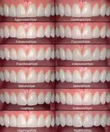 Porcelain Teeth Pictures