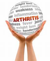 Arthritis Pain Symptoms