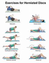 Back Exercises Herniated Disk Pictures