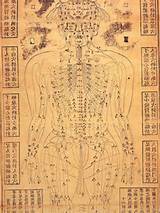 Pictures of Acupuncture Images