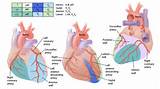 Coronary Artery Ecg Pictures