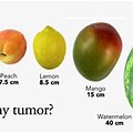 38 Cm Tumor