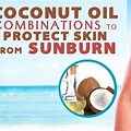 Coconut Oil Sun Burn