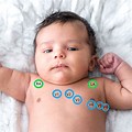 ECG Lead Placement On an Infant