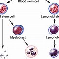 End-Stage Acute Myeloid Leukemia