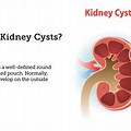 Kidney Small Cyst Treatment
