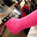 Pink Cast Crutches