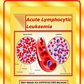 What Is Acute Lymphocytic Leukemia