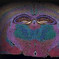 Xenium Mouse Brain Image